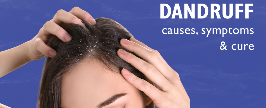 What Is Dandruff Causes Symptoms And How To Treat It Medically Pakskyline